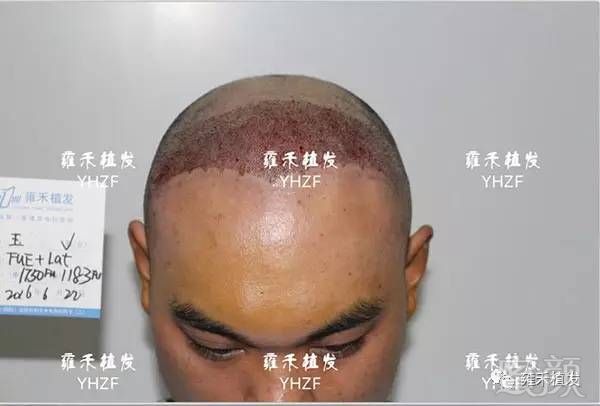 https://img.miyanlife.com/mnt/timg/180406/105RS1X-5.jpg