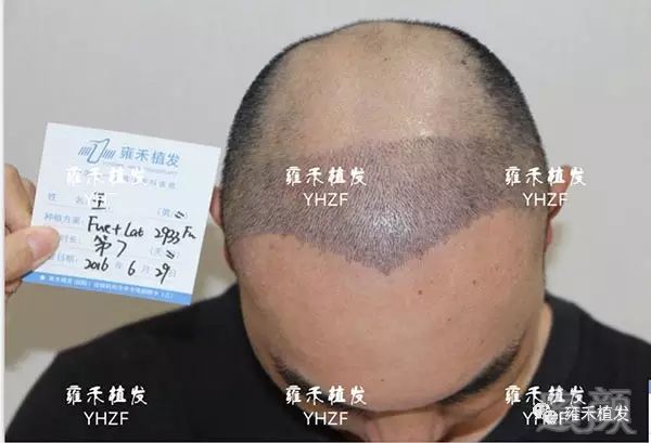 https://img.miyanlife.com/mnt/timg/180406/105RT921-6.jpg