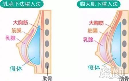 案例图片