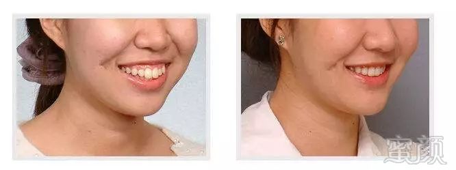 https://img.miyanlife.com/mnt/timg/180406/1243495J0-1.jpg
