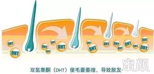 https://img.miyanlife.com/mnt/timg/180406/124R12B8-5.jpg