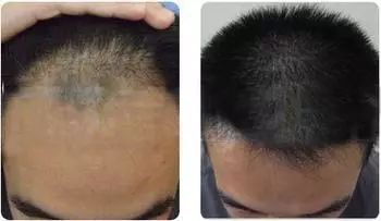 https://img.miyanlife.com/mnt/timg/180406/124R24400-8.jpg