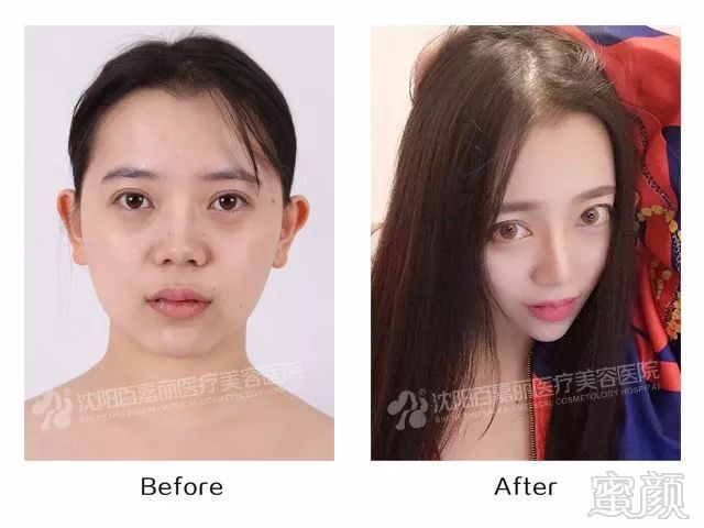 https://img.miyanlife.com/mnt/timg/180406/125F01b0-3.jpg