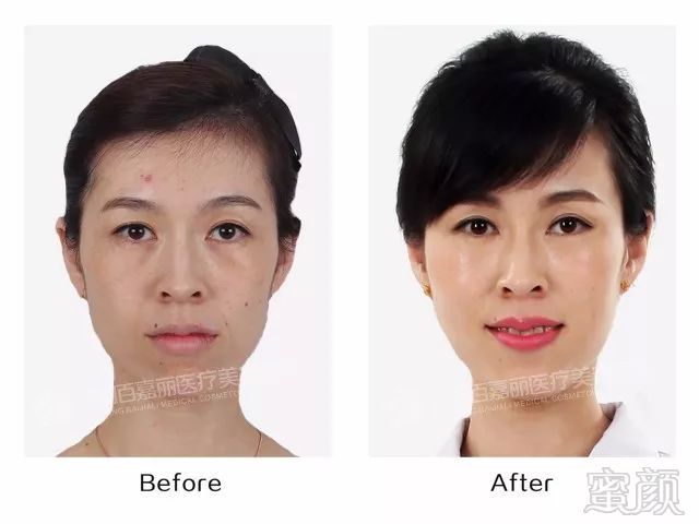 https://img.miyanlife.com/mnt/timg/180406/125F029A-2.jpg