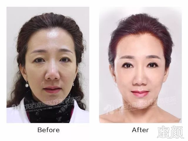https://img.miyanlife.com/mnt/timg/180406/125F04E2-4.jpg