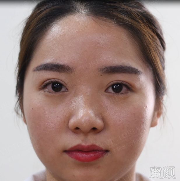 https://img.miyanlife.com/mnt/timg/180406/130GS007-2.jpg
