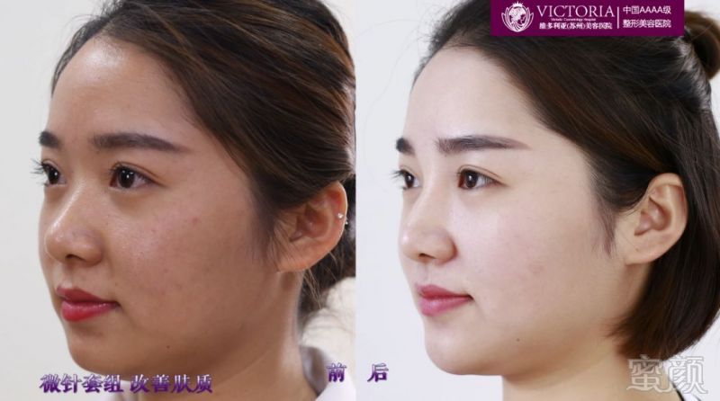 https://img.miyanlife.com/mnt/timg/180406/130H92M0-6.jpg