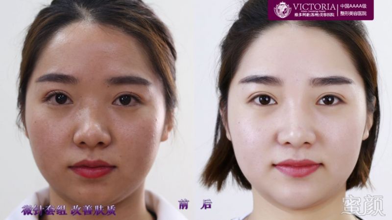https://img.miyanlife.com/mnt/timg/180406/130HJ429-5.jpg