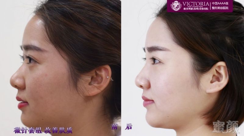https://img.miyanlife.com/mnt/timg/180406/130I01355-7.jpg