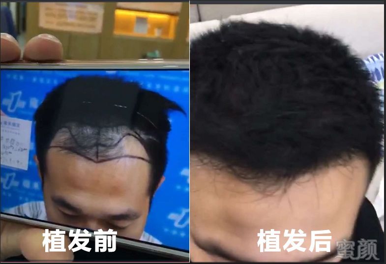 https://img.miyanlife.com/mnt/timg/180406/132K0B29-4.jpg