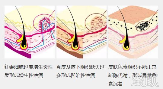 案例图片