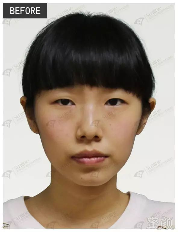 https://img.miyanlife.com/mnt/timg/180407/112S0F95-0.jpg