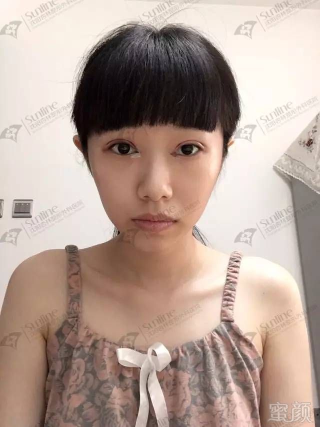 https://img.miyanlife.com/mnt/timg/180407/112S120P-4.jpg