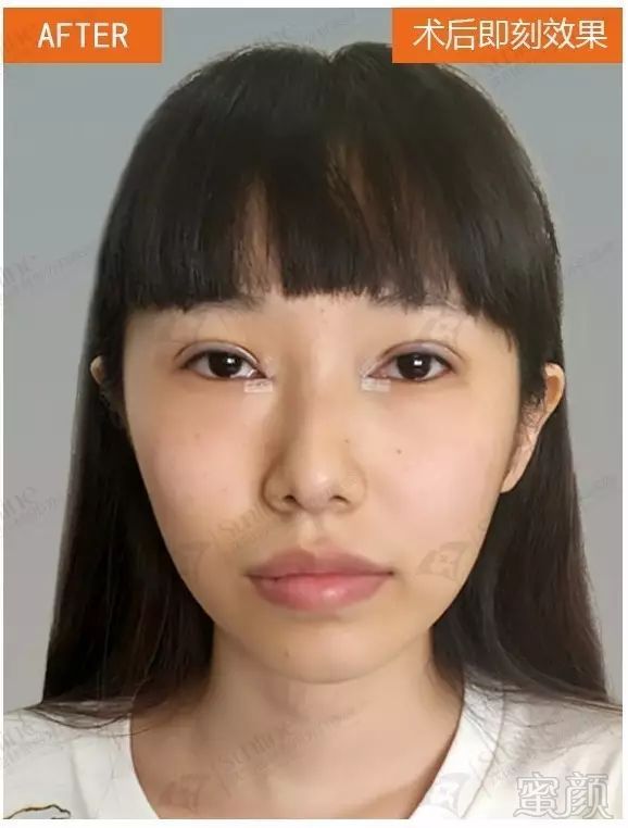 https://img.miyanlife.com/mnt/timg/180407/112S1K25-3.jpg