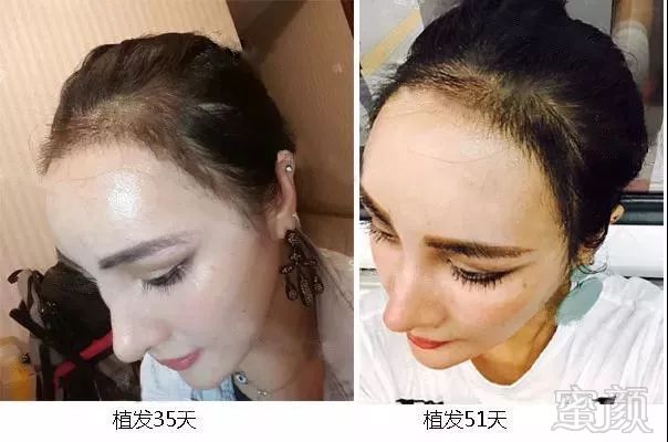 https://img.miyanlife.com/mnt/timg/180407/113G610K-3.jpg