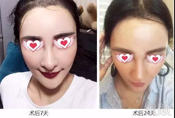 https://img.miyanlife.com/mnt/timg/180407/113G62257-2.jpg