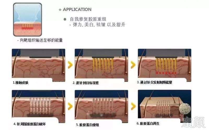 https://img.miyanlife.com/mnt/timg/180407/1206041A5-14.jpg
