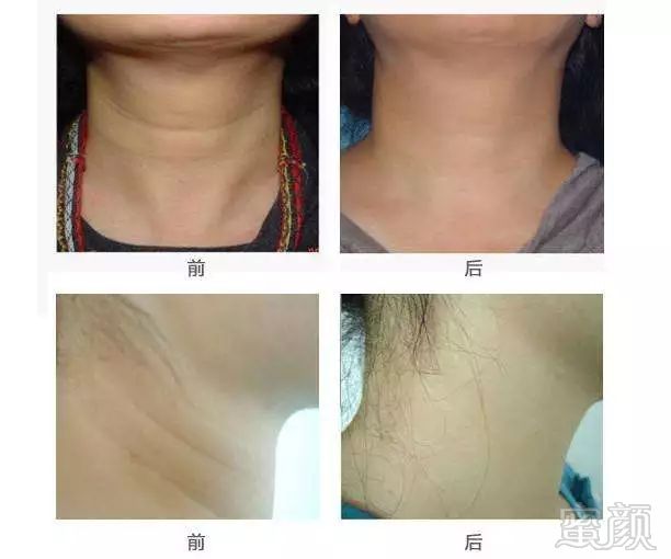 https://img.miyanlife.com/mnt/timg/180407/120604K02-15.jpg