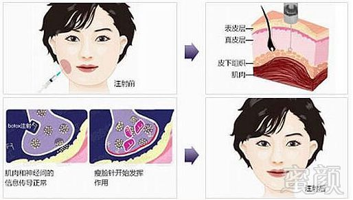 https://img.miyanlife.com/mnt/timg/180407/1212143D2-2.jpg