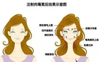 https://img.miyanlife.com/mnt/timg/180407/1212144036-3.jpg