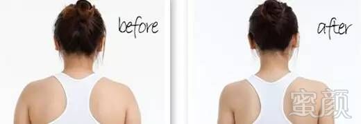 https://img.miyanlife.com/mnt/timg/180407/121215H11-11.jpg