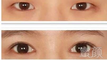 https://img.miyanlife.com/mnt/timg/180407/12124445J-5.jpg