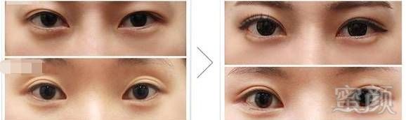https://img.miyanlife.com/mnt/timg/180407/12124562M-8.jpg