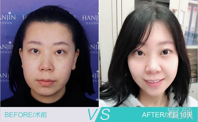 https://img.miyanlife.com/mnt/timg/180407/1214391343-4.jpg