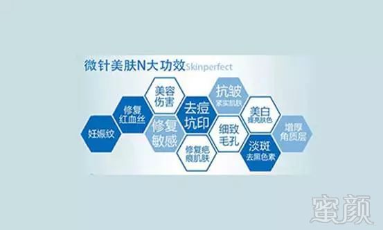 https://img.miyanlife.com/mnt/timg/180407/12143LG1-1.jpg