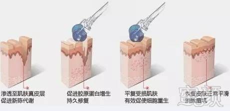 https://img.miyanlife.com/mnt/timg/180407/12143S917-2.jpg