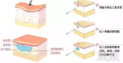 案例图片