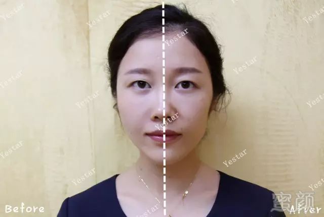 https://img.miyanlife.com/mnt/timg/180407/1219332H6-6.jpg