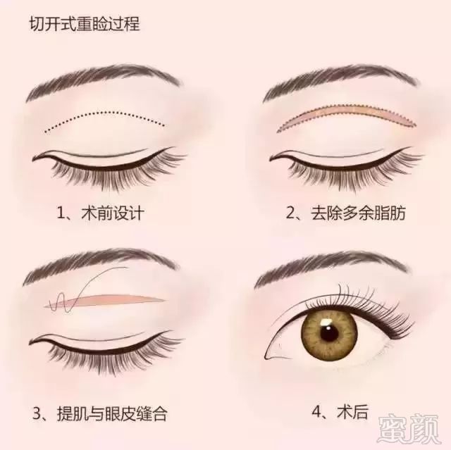 https://img.miyanlife.com/mnt/timg/180407/1224231N4-7.jpg