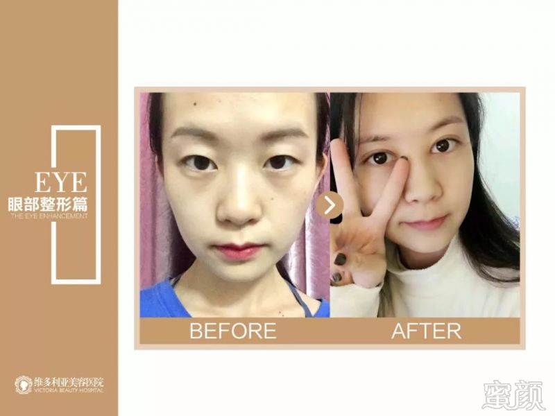 https://img.miyanlife.com/mnt/timg/180407/1224255206-15.jpg