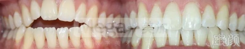https://img.miyanlife.com/mnt/timg/180407/12244220M-5.jpg