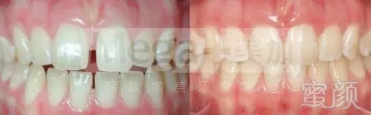 https://img.miyanlife.com/mnt/timg/180407/122442J61-4.jpg
