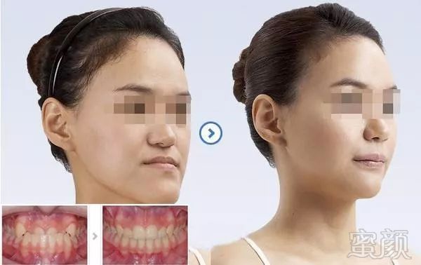https://img.miyanlife.com/mnt/timg/180407/1225235327-2.jpg