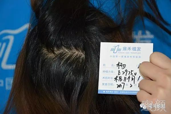 https://img.miyanlife.com/mnt/timg/180407/1243254Y4-10.jpg