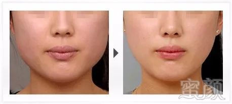https://img.miyanlife.com/mnt/timg/180407/125T41408-4.jpg