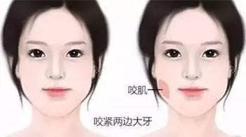 https://img.miyanlife.com/mnt/timg/180407/125T450L-2.jpg