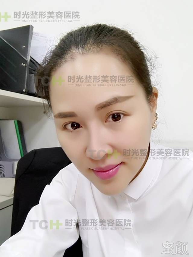 https://img.miyanlife.com/mnt/timg/180407/133030G53-9.jpg