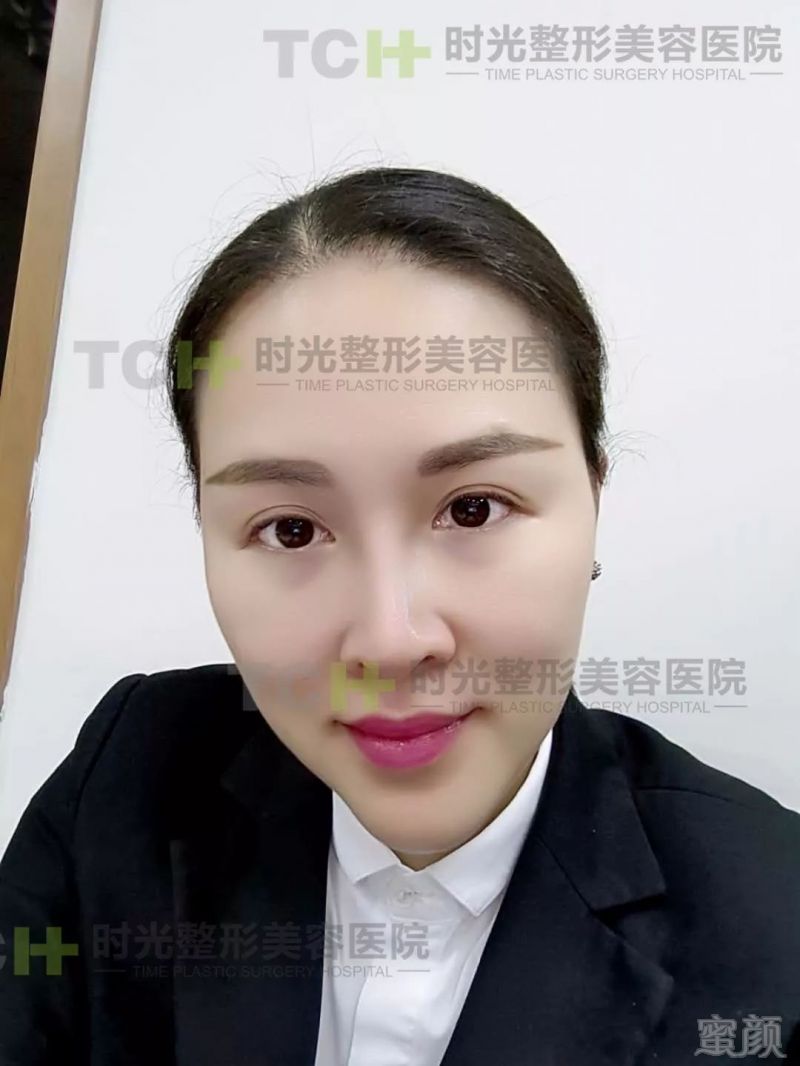 https://img.miyanlife.com/mnt/timg/180407/1330316243-11.jpg
