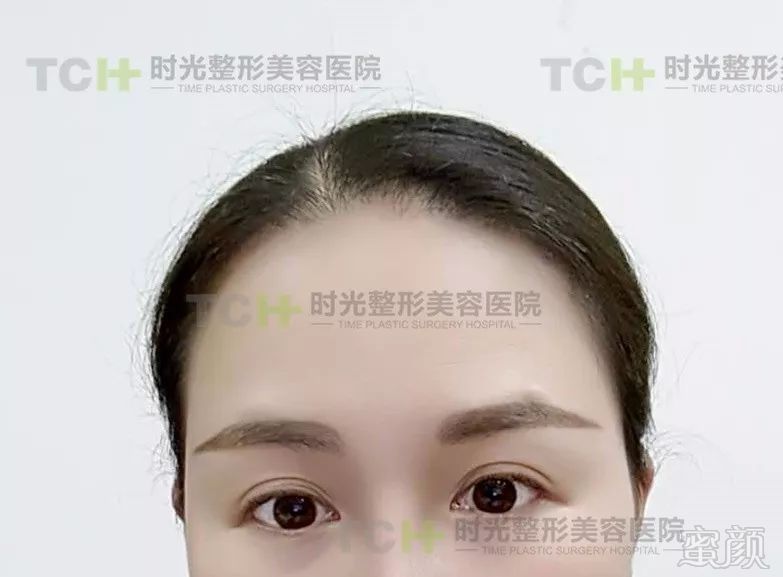 https://img.miyanlife.com/mnt/timg/180407/1330335094-12.jpg