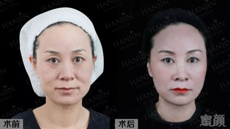 https://img.miyanlife.com/mnt/timg/180408/1003126445-5.jpg