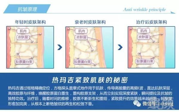 https://img.miyanlife.com/mnt/timg/180408/101950B01-2.jpg