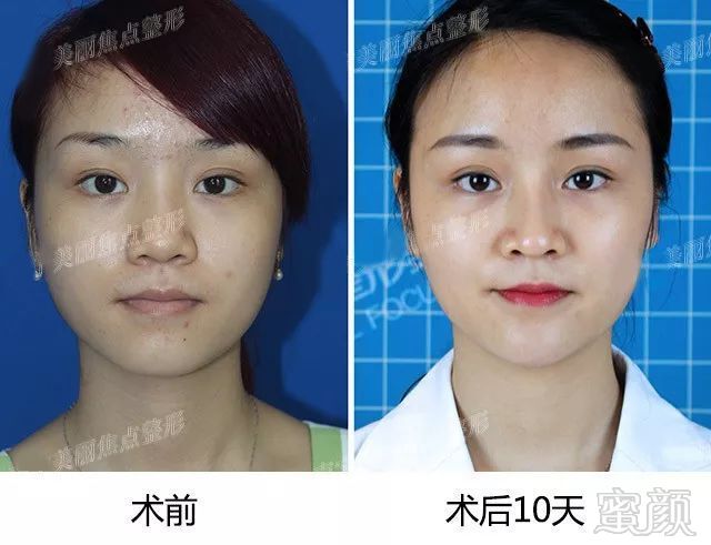 https://img.miyanlife.com/mnt/timg/180408/10233I519-3.jpg