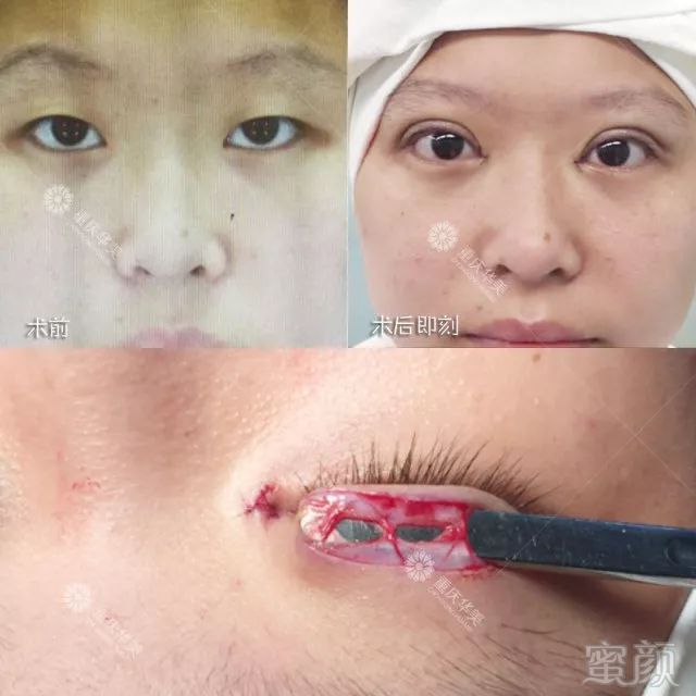 https://img.miyanlife.com/mnt/timg/180408/1133401534-10.jpg