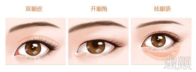 https://img.miyanlife.com/mnt/timg/180408/113G914a-4.jpg