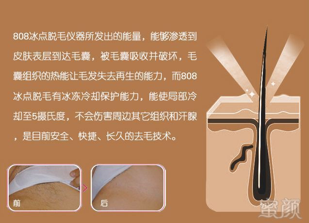 https://img.miyanlife.com/mnt/timg/180408/114135G13-9.jpg
