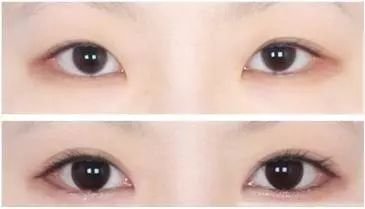 https://img.miyanlife.com/mnt/timg/180408/1151062432-0.jpg
